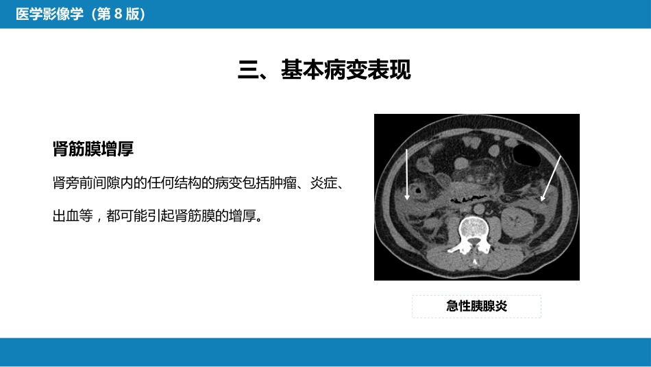 第八章 泌尿生殖系统与腹膜后间隙 第五节 腹膜后间隙_第9页