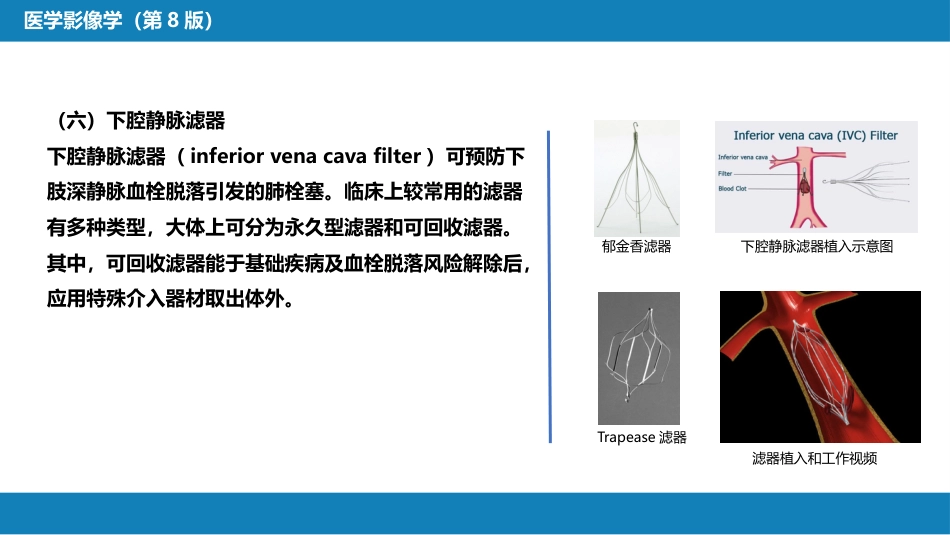 第十二章 介入放射学总论_第12页