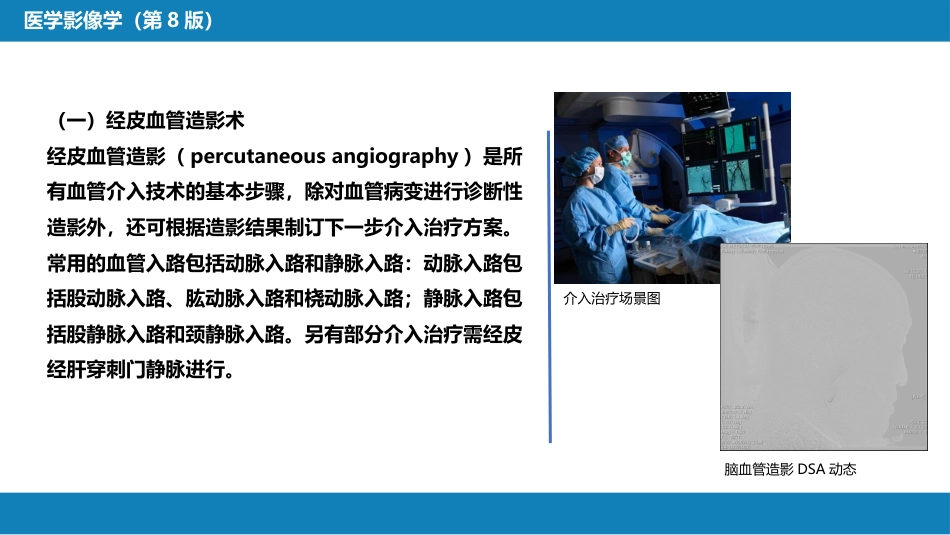 第十二章 介入放射学总论_第15页