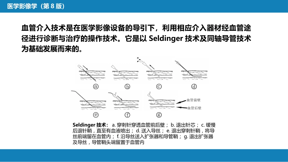 第十二章 介入放射学总论_第6页