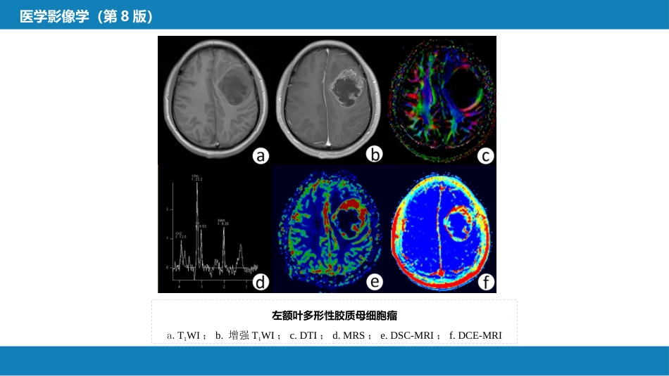 第二章 中枢神经系统 第四节 疾病诊断_第10页