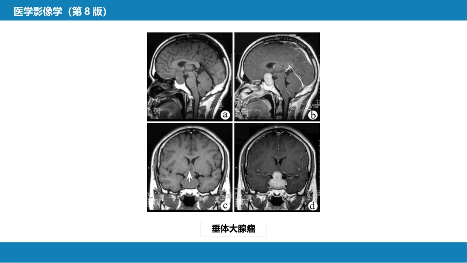 第二章 中枢神经系统 第四节 疾病诊断_第15页