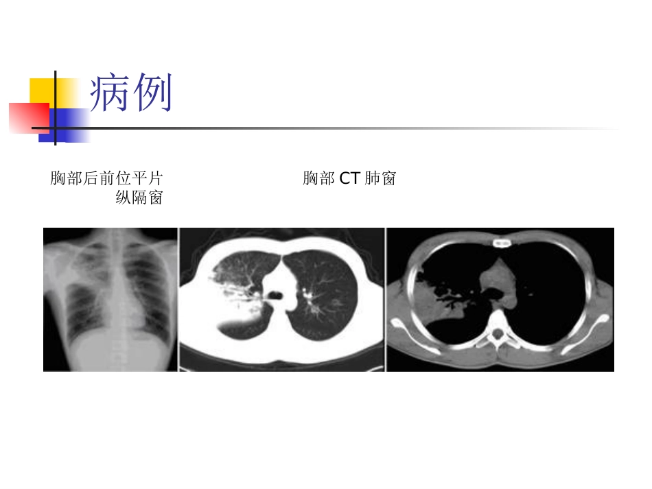大叶性肺炎的影像诊断-23页_第3页