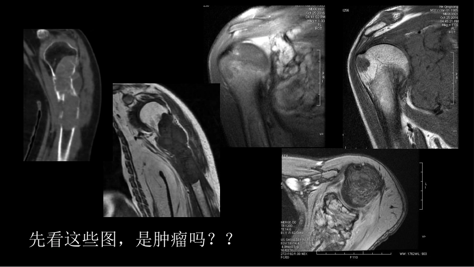 影像诊断学习与扩展：代谢性骨病(病例23)_第2页