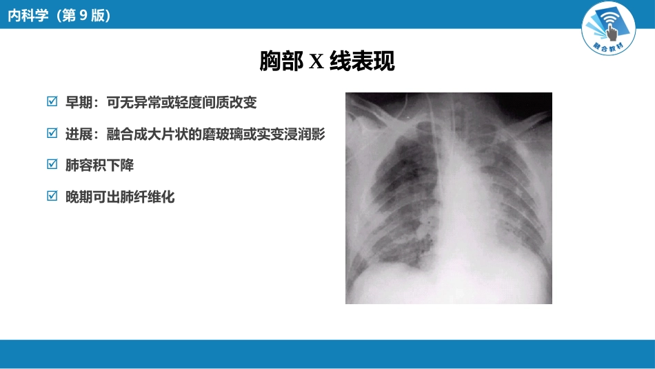 呼吸系统疾病：急性呼吸窘迫综合征_第7页