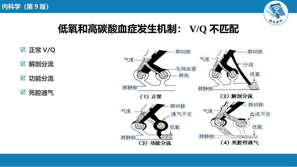呼吸系统疾病：呼吸衰竭与呼吸支持技术_第10页
