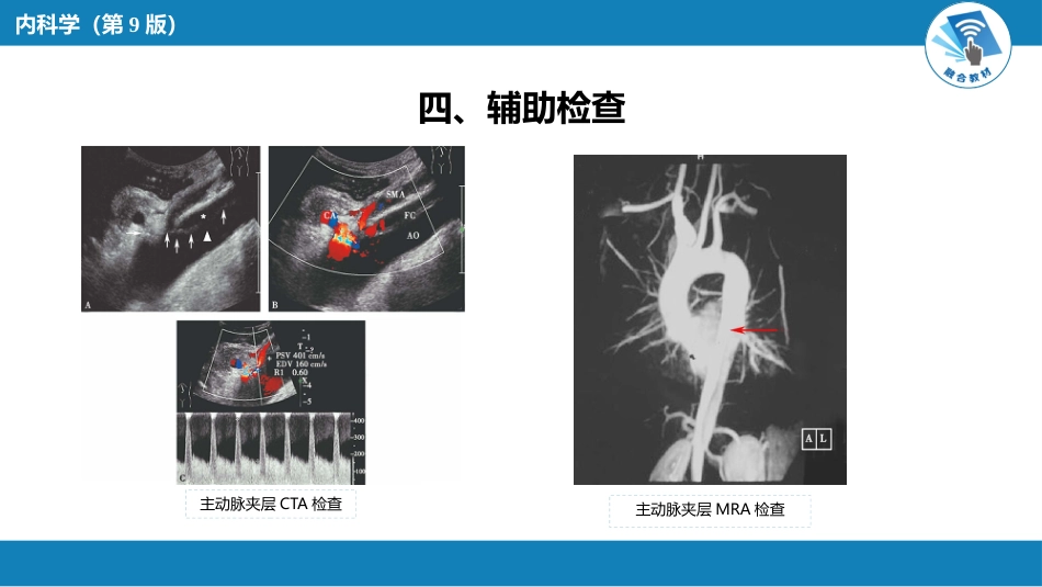 心内科：  主动脉疾病和周围血管病_第9页