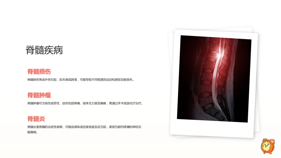 神经外科基本知识课件ppt_第9页