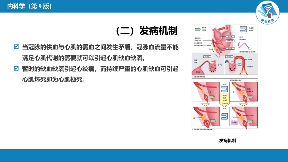 心内科： 动脉粥样硬化和冠状动脉粥样硬化性心脏病_第15页