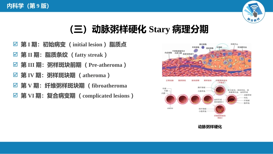 心内科： 动脉粥样硬化和冠状动脉粥样硬化性心脏病_第8页