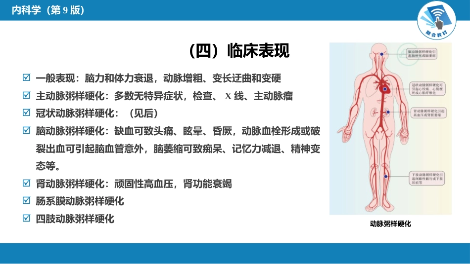 心内科： 动脉粥样硬化和冠状动脉粥样硬化性心脏病_第9页
