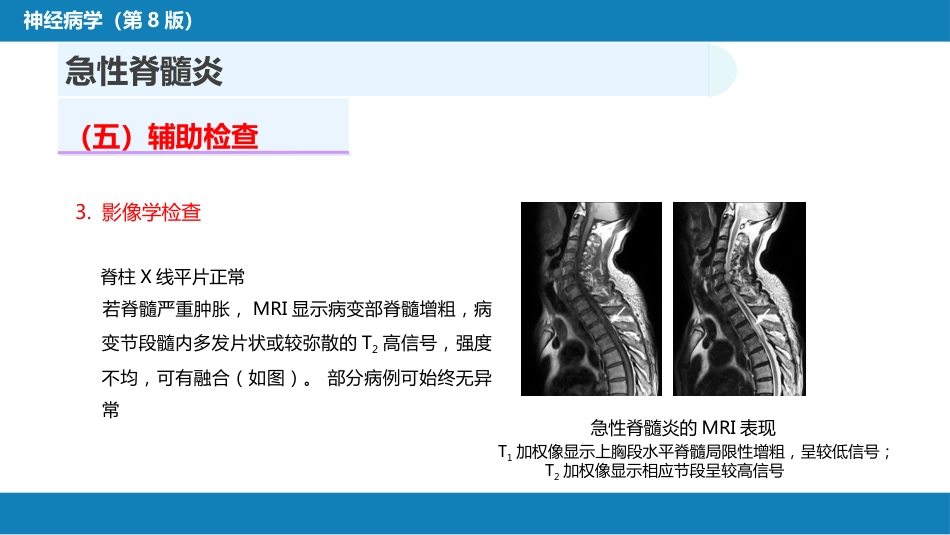 第十六章 脊髓疾病_第14页