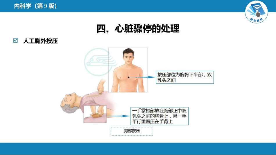 心内科：心脏骤停与心脏性猝死_第12页