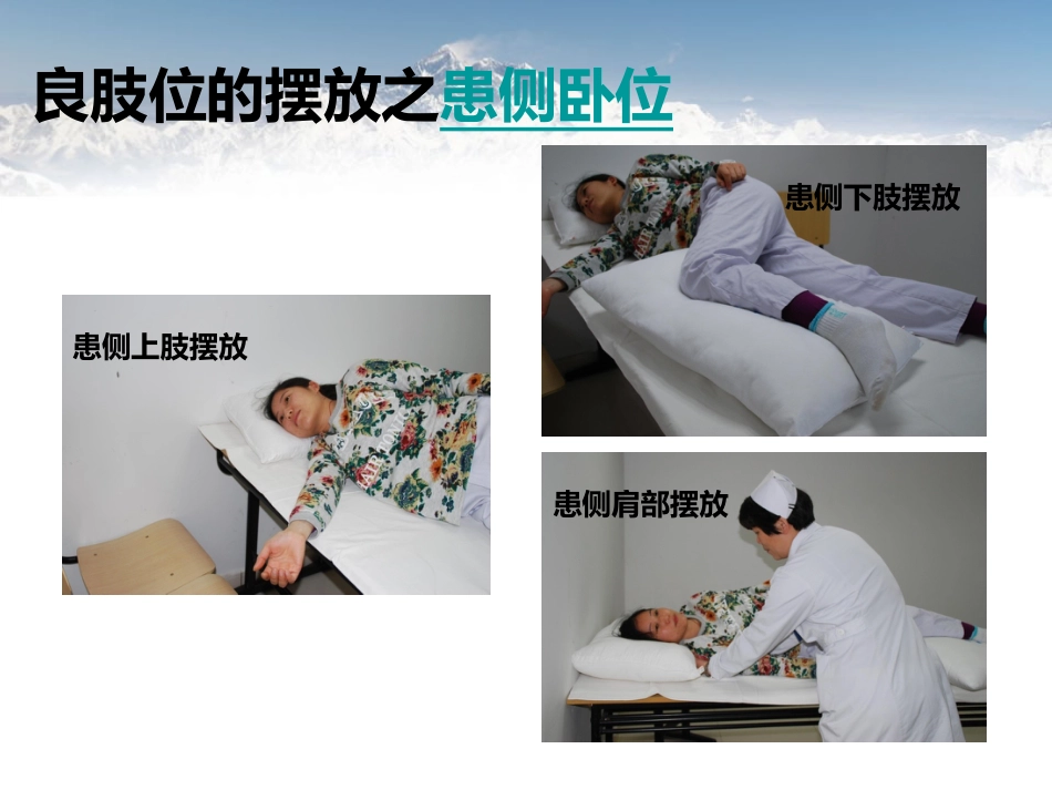 脑卒中病人早期功能锻炼_第9页
