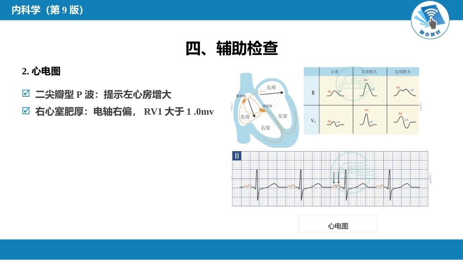 心内科：心脏瓣膜病_第15页