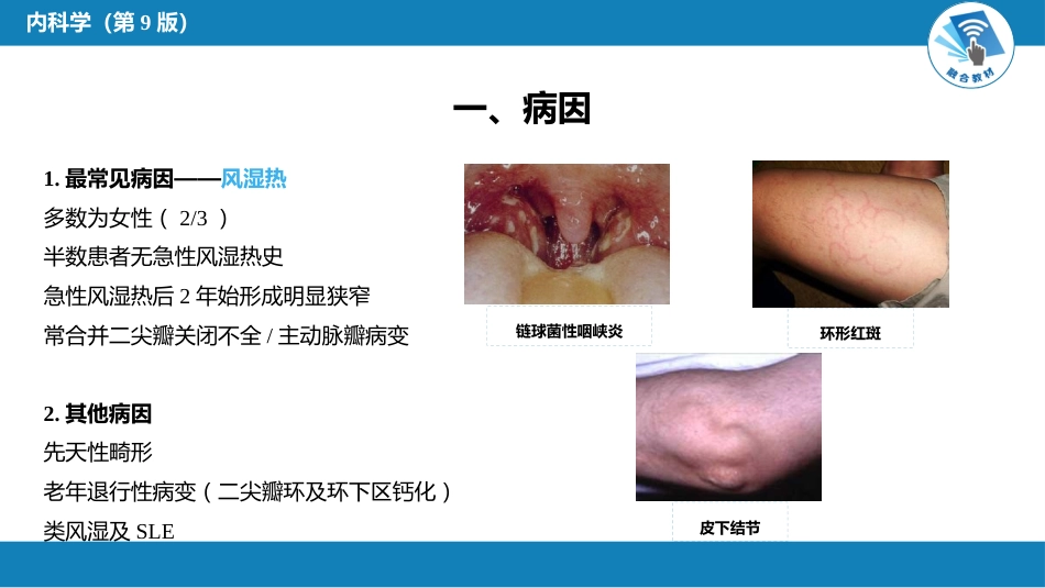心内科：心脏瓣膜病_第6页