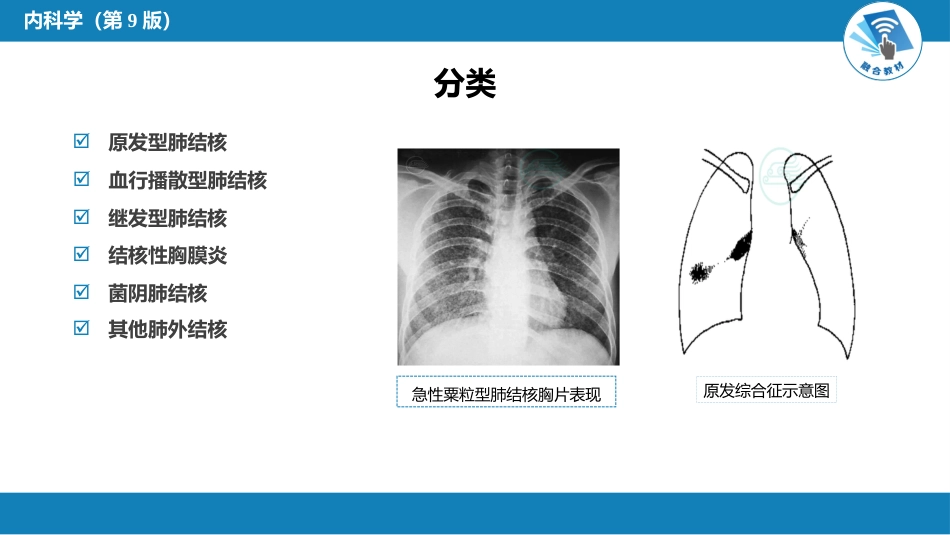 呼吸系统疾病： 肺结核_第11页