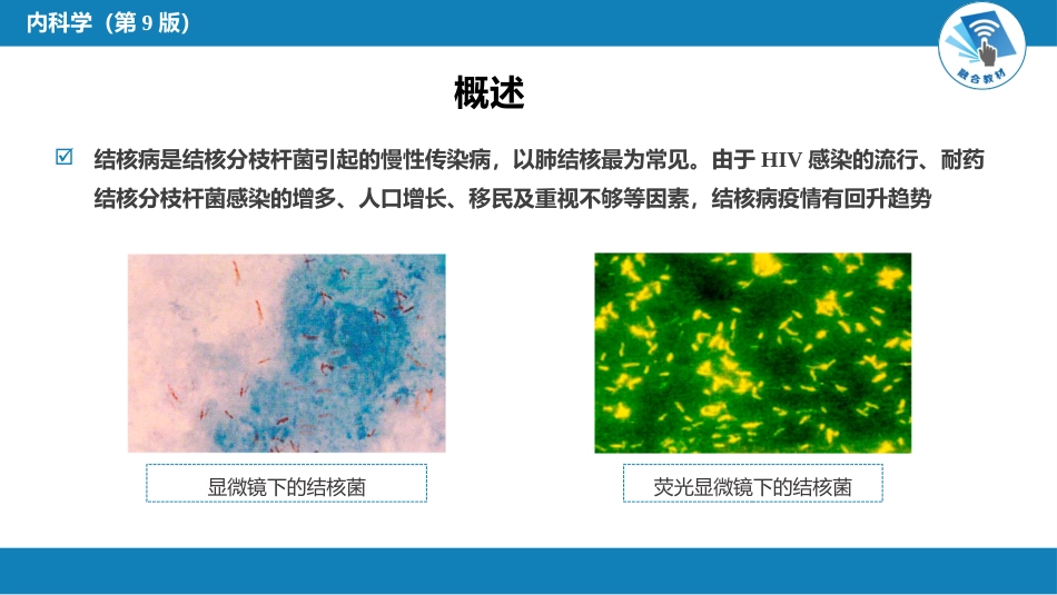 呼吸系统疾病： 肺结核_第3页