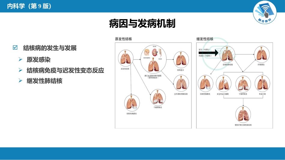呼吸系统疾病： 肺结核_第5页