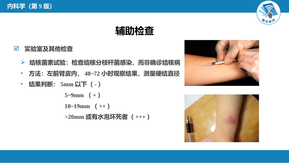 呼吸系统疾病： 肺结核_第9页
