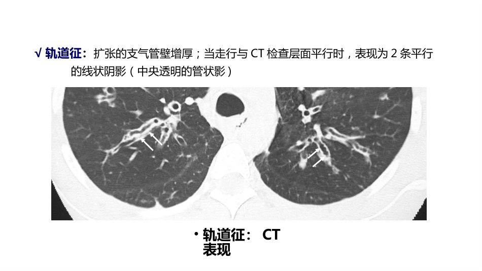 呼吸系统——支气管扩张症、肺炎_第13页