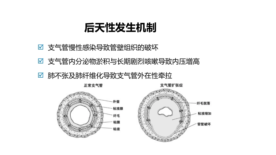 呼吸系统——支气管扩张症、肺炎_第6页