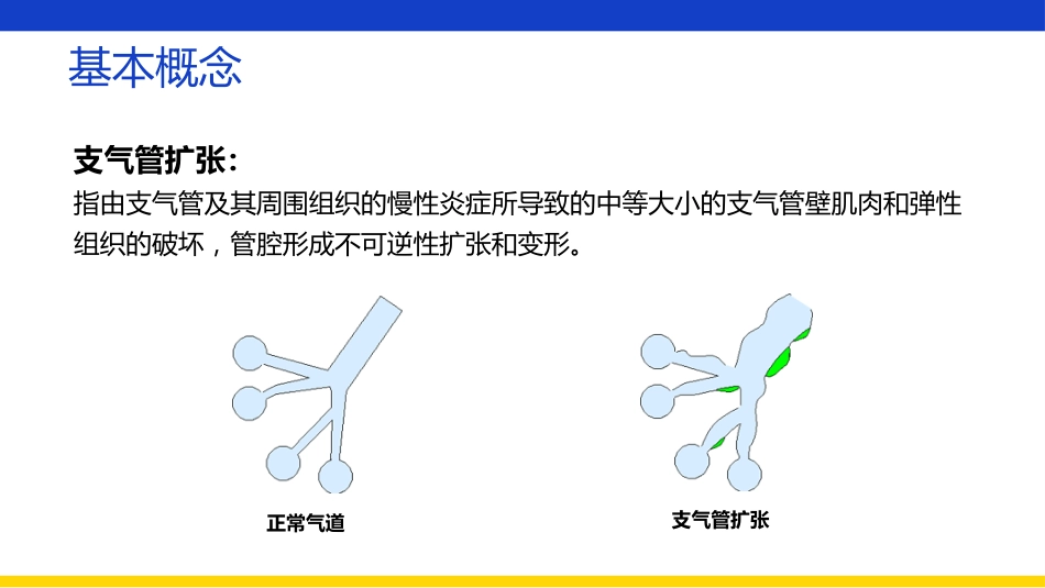 支气管扩张伴大咯血患者查房_第6页
