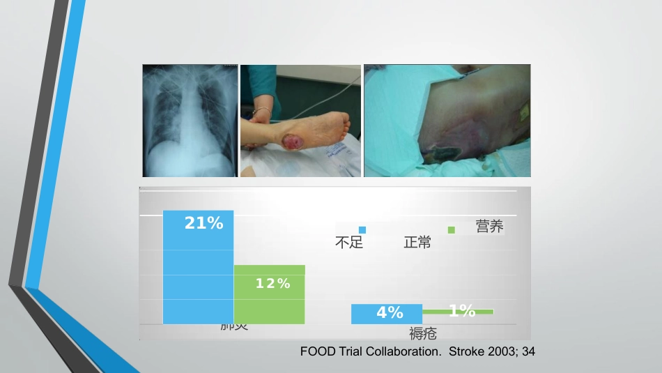神经危重症患者营养支持_第12页