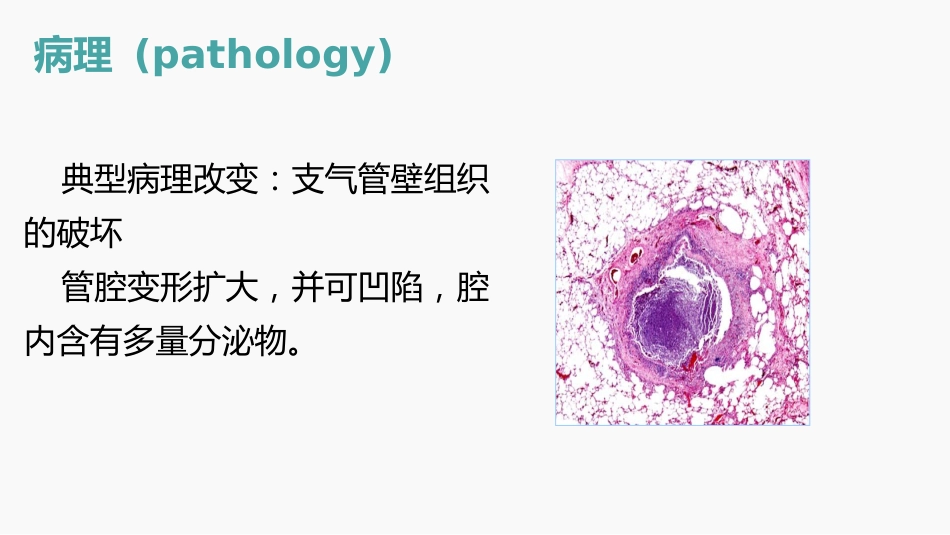 支气管扩张的护理查房_第9页