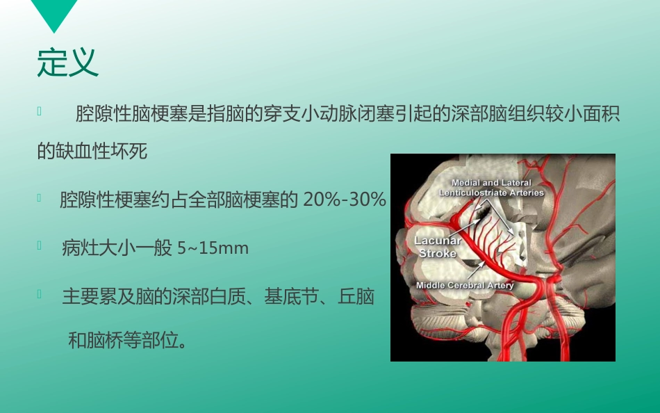 腔隙性脑梗塞_第3页