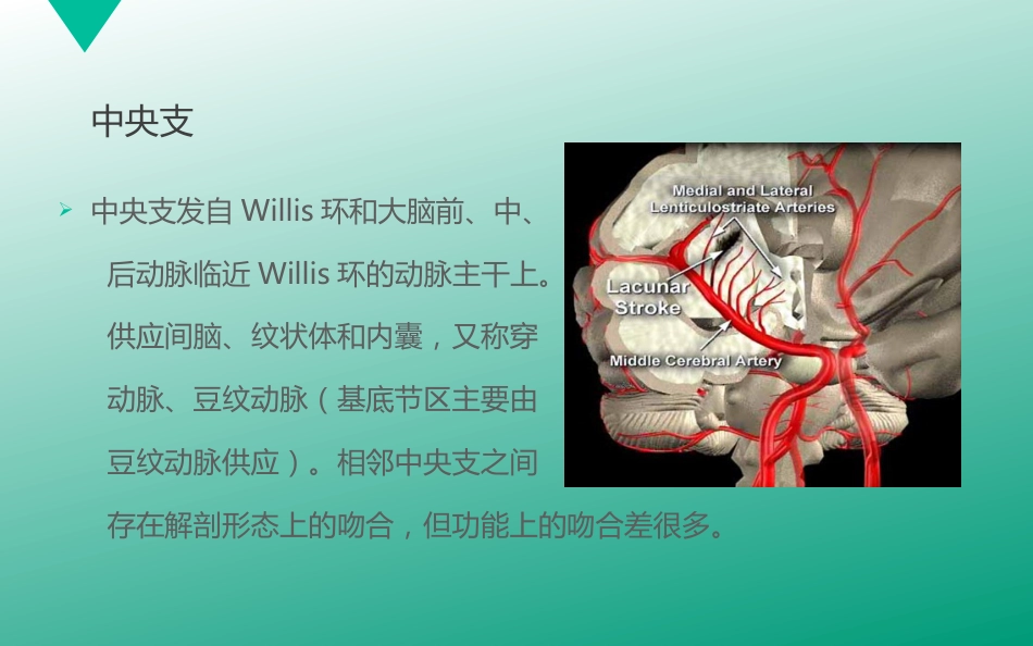 腔隙性脑梗塞_第8页