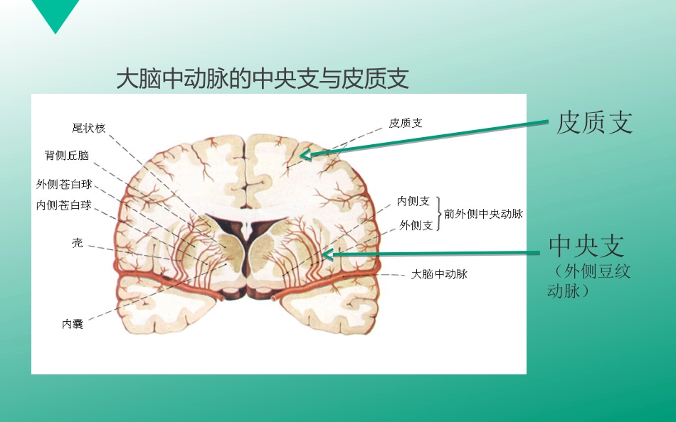 腔隙性脑梗塞_第9页