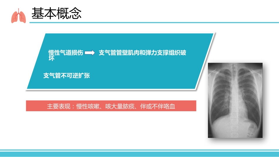 支气管扩张病人的护理1_第5页