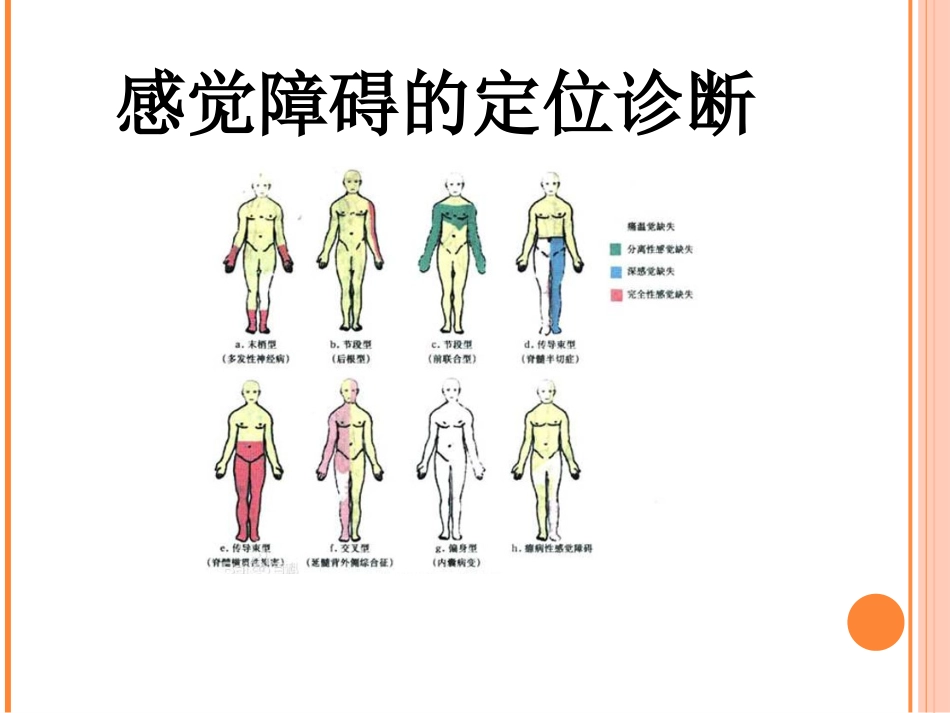 神经内科常见症状及护理_第14页
