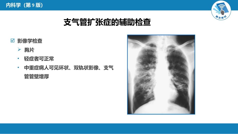 呼吸系统疾病：支气管扩张_第11页