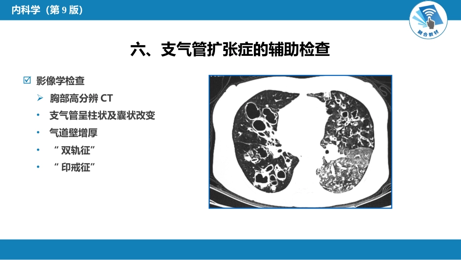 呼吸系统疾病：支气管扩张_第12页