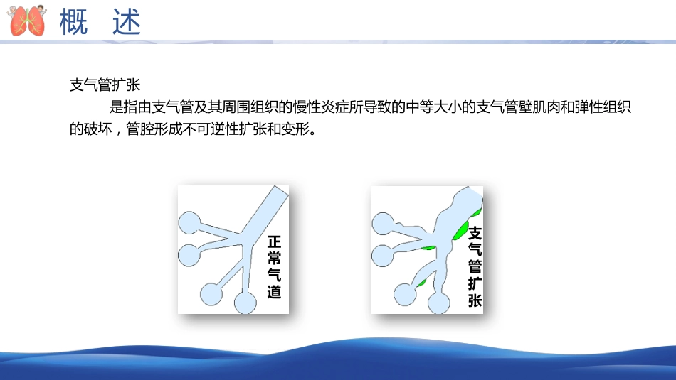 支气管扩张病人的护理2_第4页