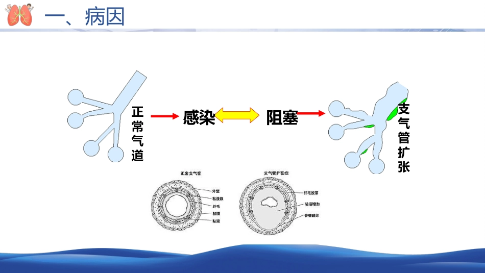 支气管扩张病人的护理2_第6页