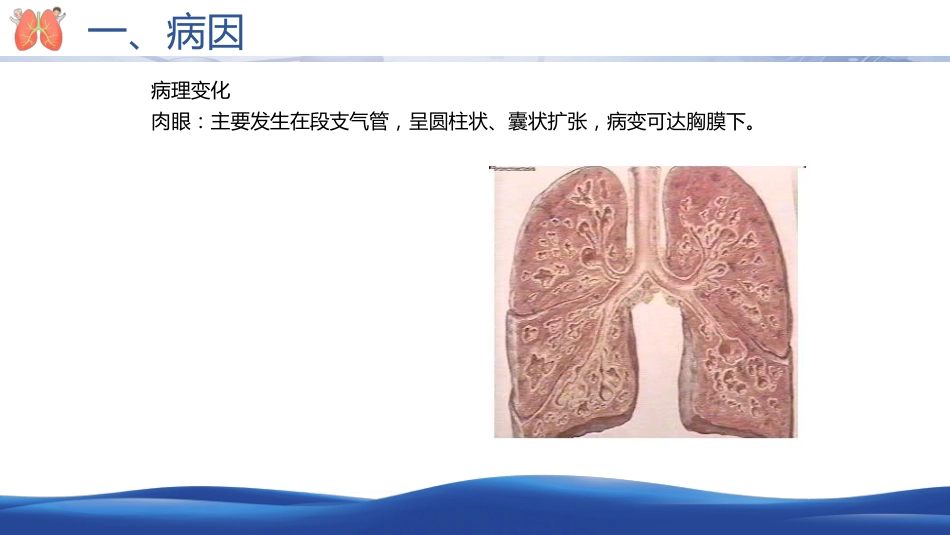 支气管扩张病人的护理2_第8页