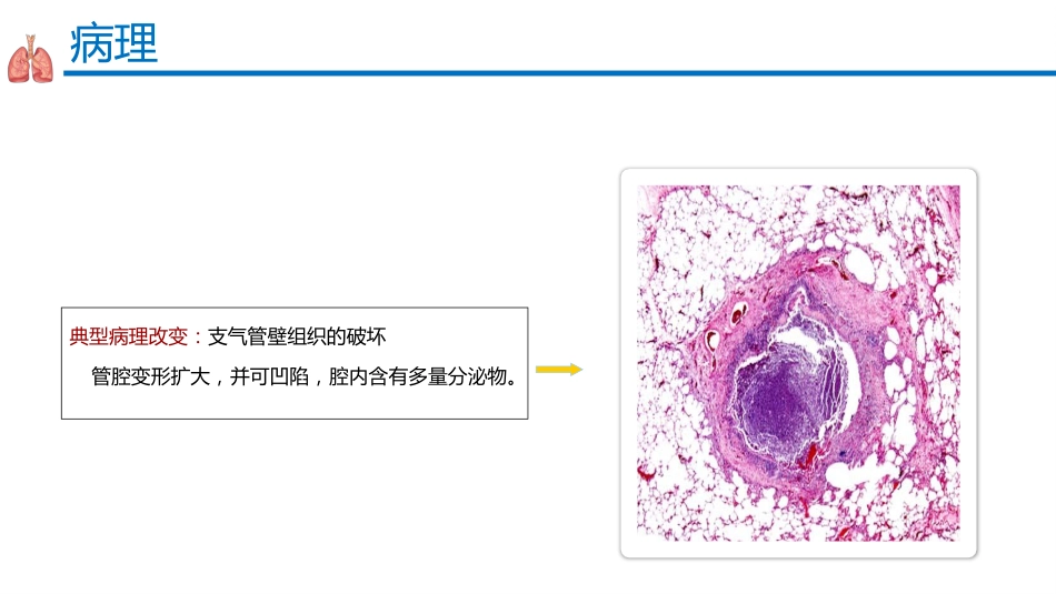 支气管扩张症2_第10页