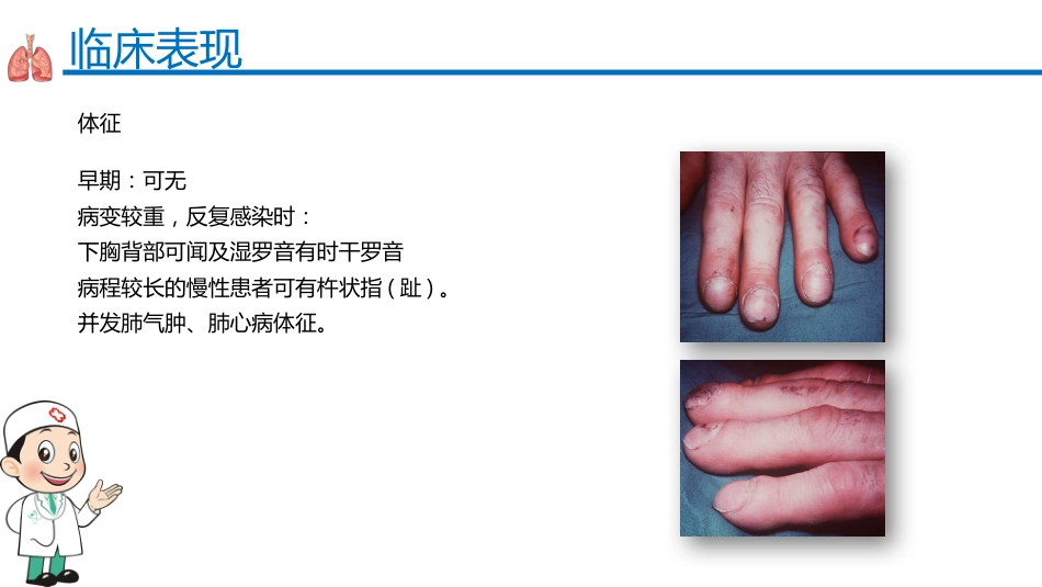 支气管扩张症2_第14页