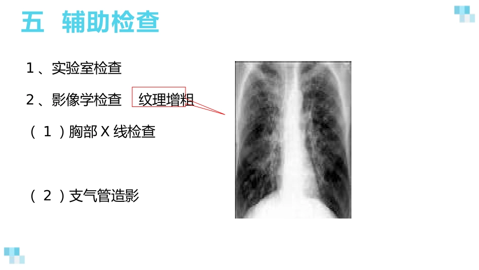 支气管扩张2_第10页