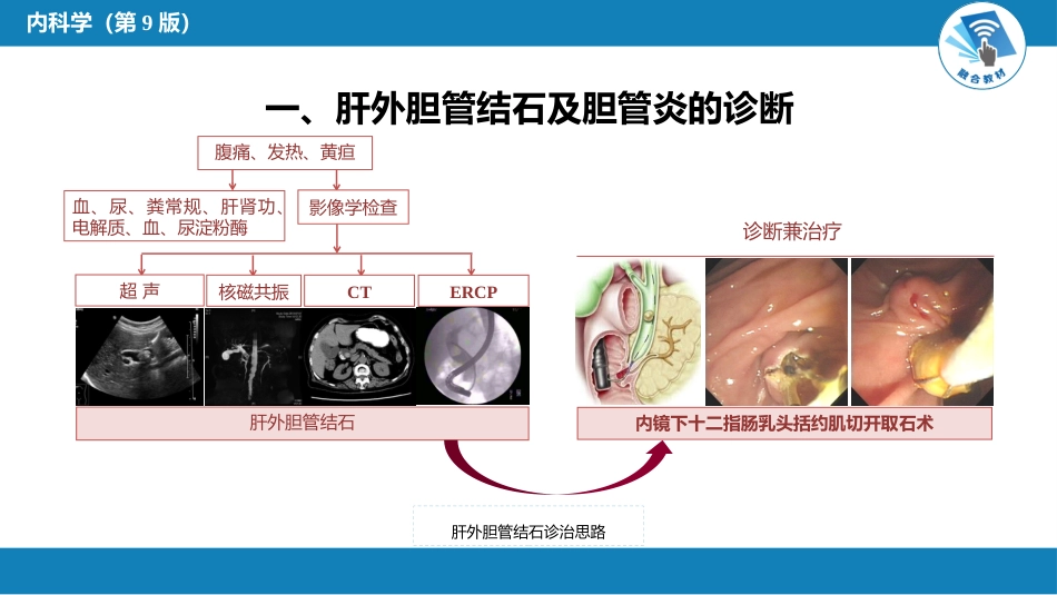 消化内科：肝外胆系结石及炎症_第11页