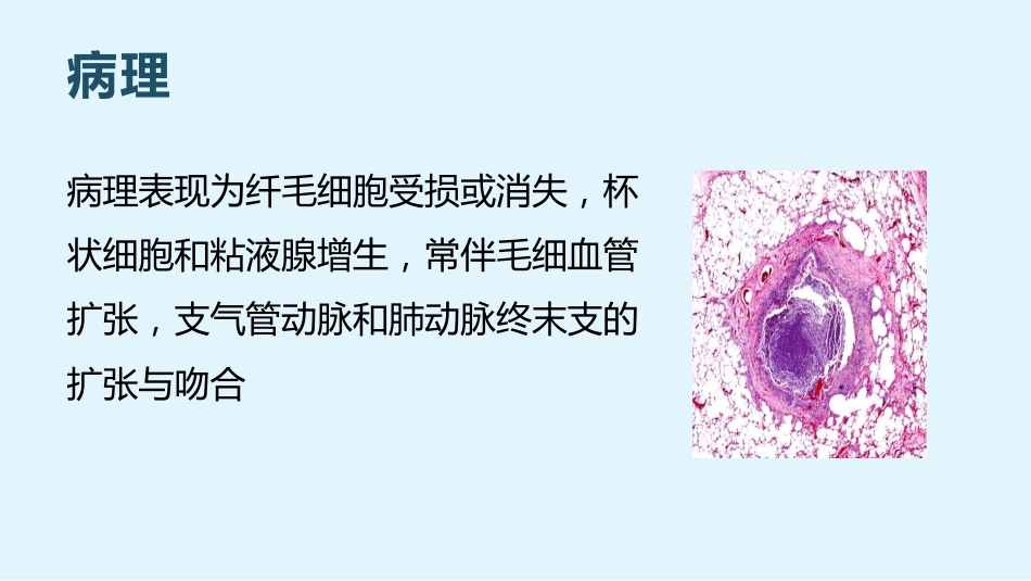 支气管扩张3_第13页