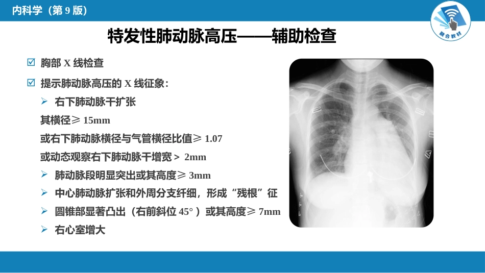 呼吸系统疾病：肺动脉高压与肺源性心脏病_第8页