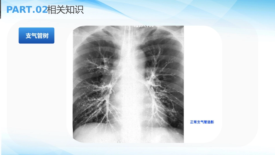 支气管扩张病人的护理3_第13页