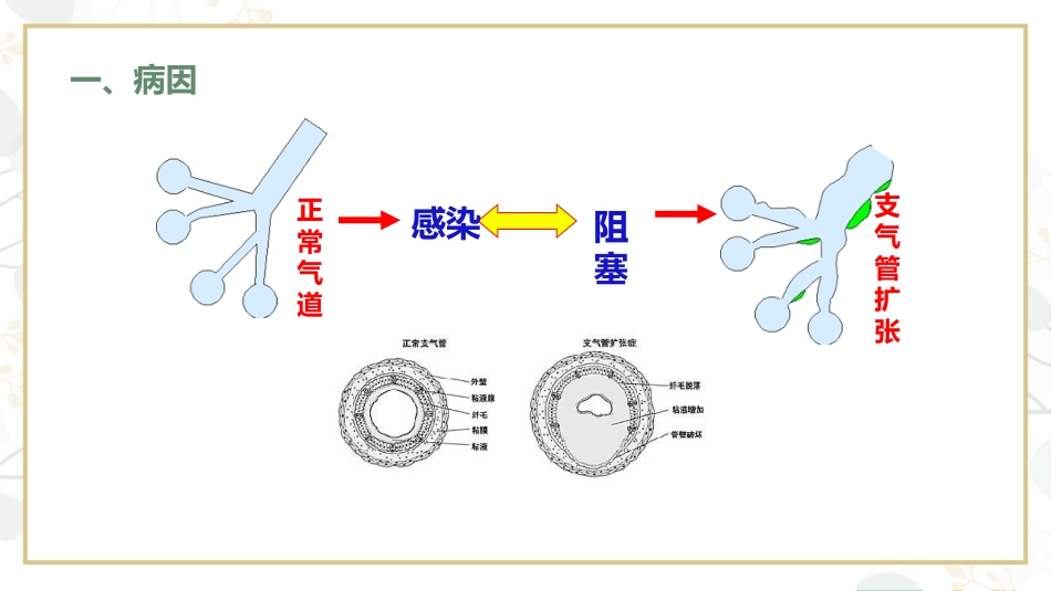 支气管扩张病人的护理4_第5页