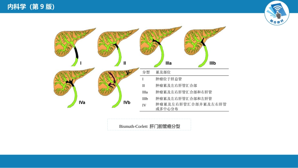 消化内科：胆道系统肿瘤_第11页