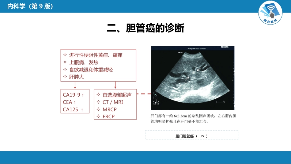 消化内科：胆道系统肿瘤_第12页