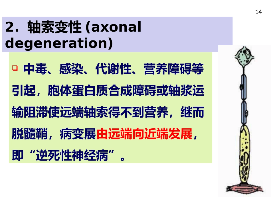 周围神经病_第14页